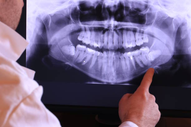 Best Emergency Dental Care for Broken or Chipped Teeth in Garden City, ID
